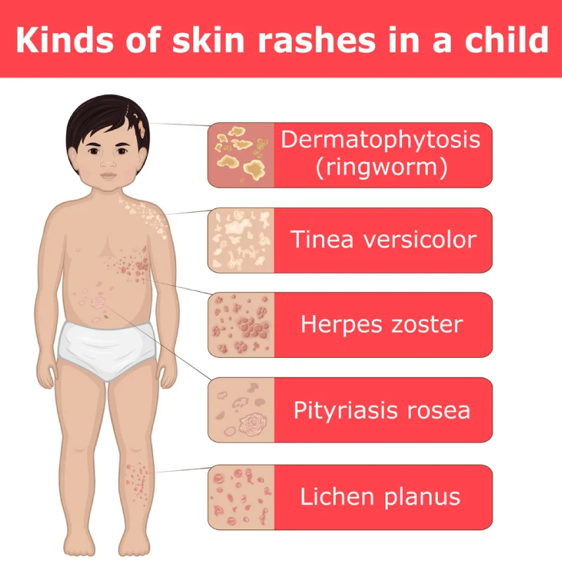 Pediatric & Sensitive Skin Care